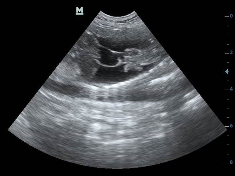 Hidropsia fetal na ultrassonografia veterinária